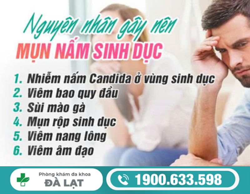 Hình ảnh minh họa